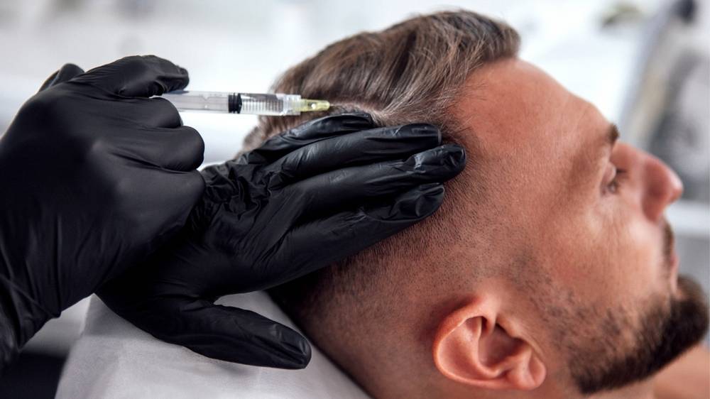Understanding the journey of hair restoration in the city 2 Understanding the journey of hair restoration in the city 2